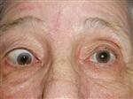 COPYRIGHT 2009 AMERICAN ACDEMY OF OPHTHALMOOGY